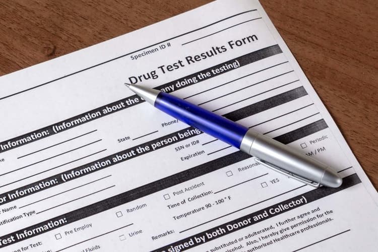 Does Delta 8 Show Up On A Drug Test? Will You Pass? Delta North