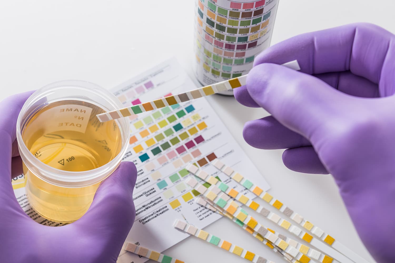 Drug test being conducted